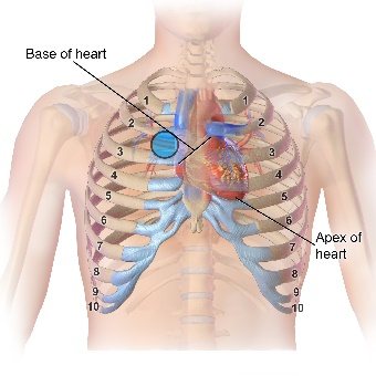 TAVR nursing care