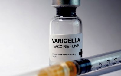 Everything You Need to Know About Varicella