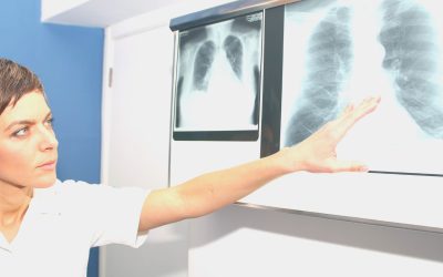 Exploring the Causes and Symptoms of Pulmonary Embolism