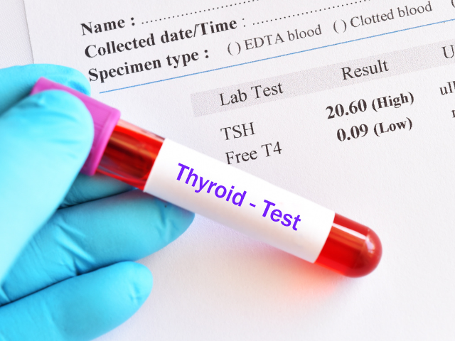 Hypothyroidism